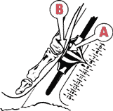 �I�[���I�[�o�[�����O�X�ƃA�[�`�����O�X �u�����m�b�N�f�o�C�X Brannock Device